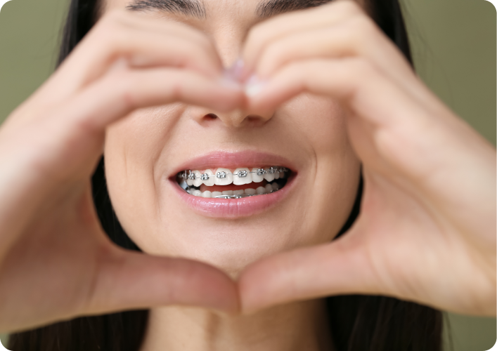 Mains en forme de cœur autour d'un sourire avec bagues
