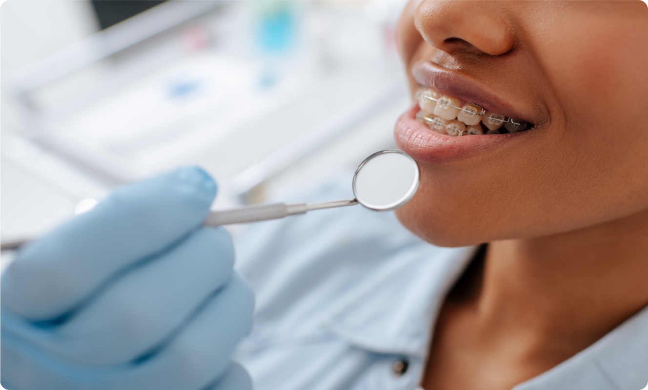 Examen dentaire réalisé avec un miroir de bouche
